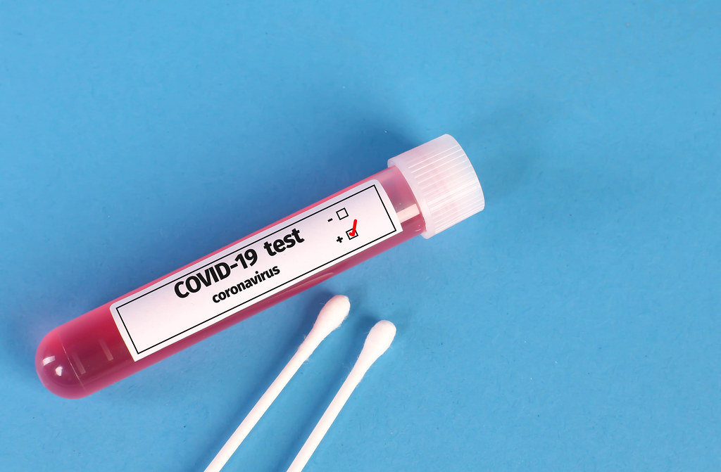 Tube with positive blood samples for Coronavirus test