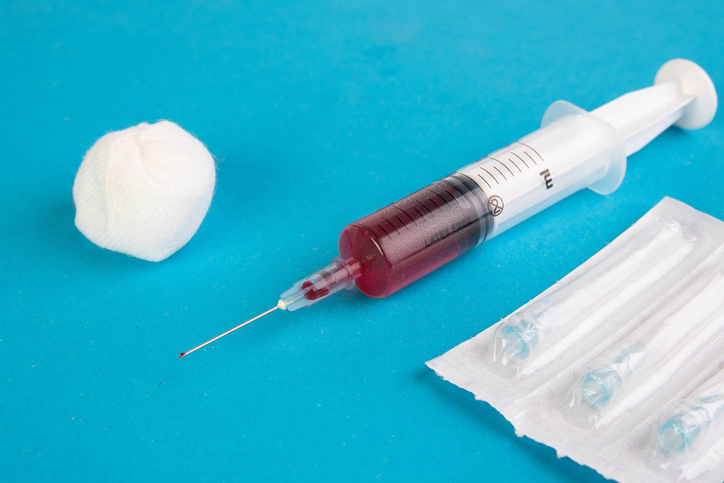Blood sample in syringe