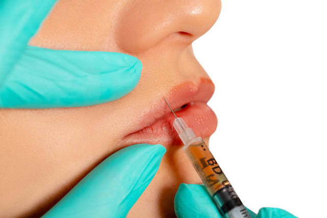 Cosmetic injection in the lips, close-up