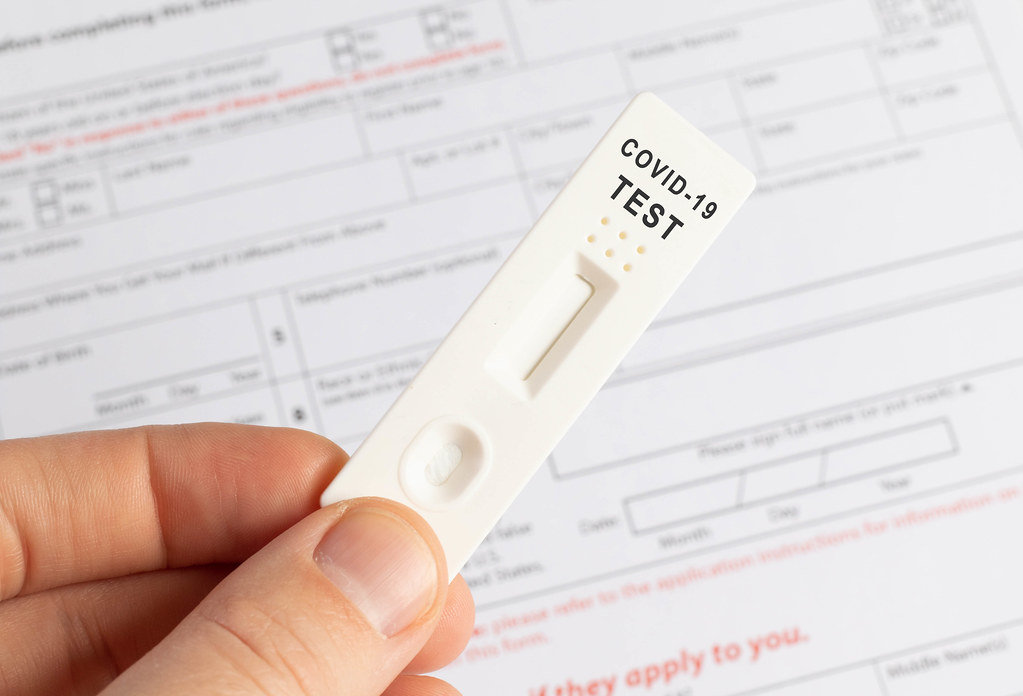 Hand holds a covid-19 antigen test