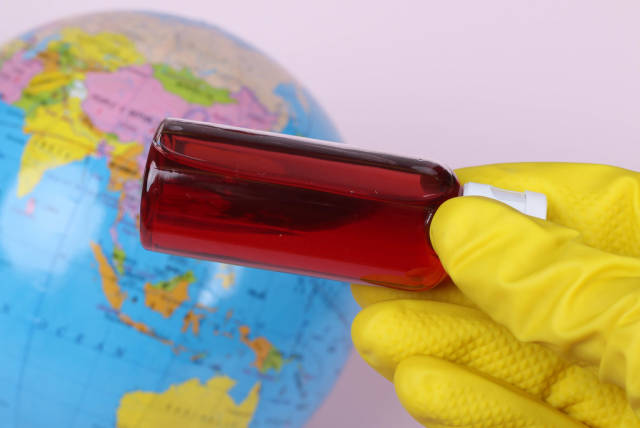 Scientist holding blood sample in test tube with globe in the background