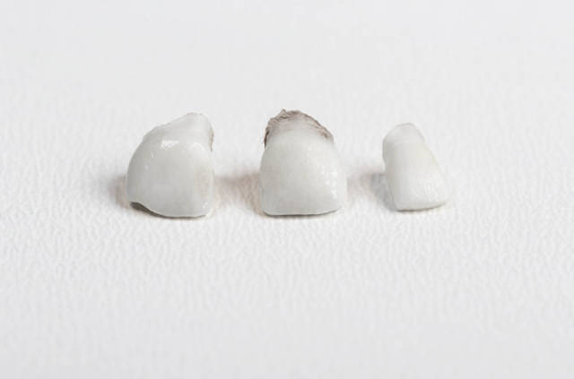 Childrens first baby teeth that fell out on a white background
