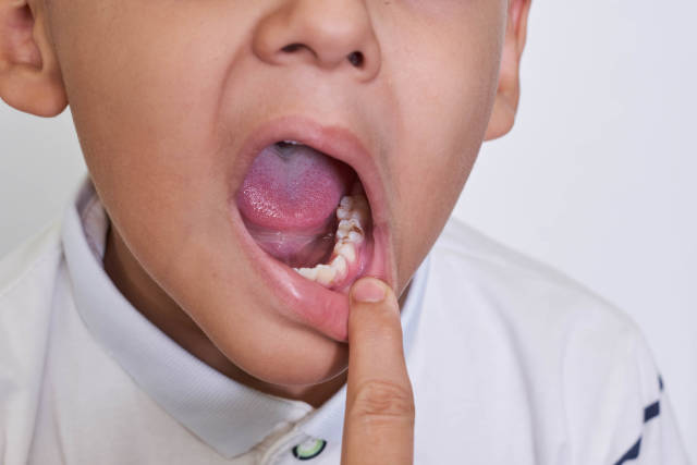 Periodic checking children teeth to detect tooth caries